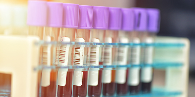 test tube samples